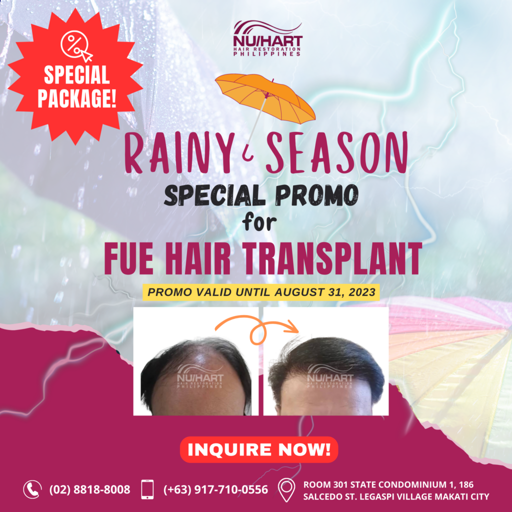 Affordable Hair Transplant Manila Philippines Best Promos