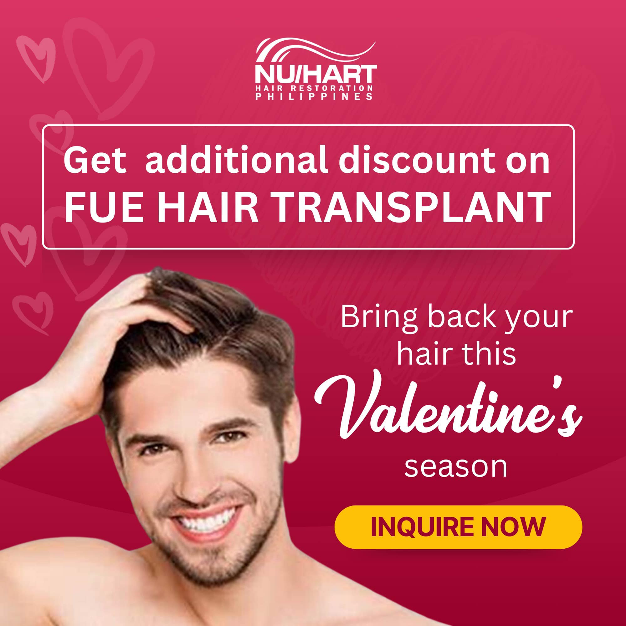 Affordable Hair Transplant Manila Philippines Best Promos