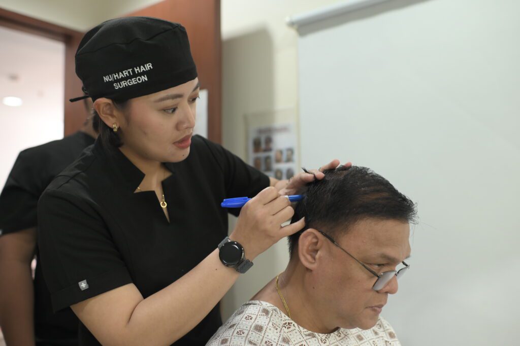 NU/HART medical team providing hair restoration consultations