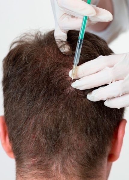 Growth Factor Treatment2
